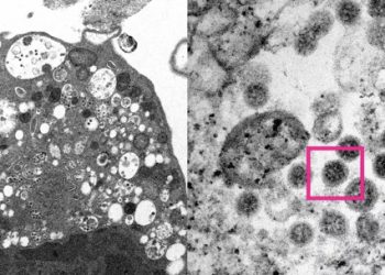Reino Unido tem primeira morte por variante ômicron da Covid-19