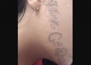 ‘Tentou me matar diversas vezes’, diz jovem que teve o rosto tatuado pelo ex-namorado