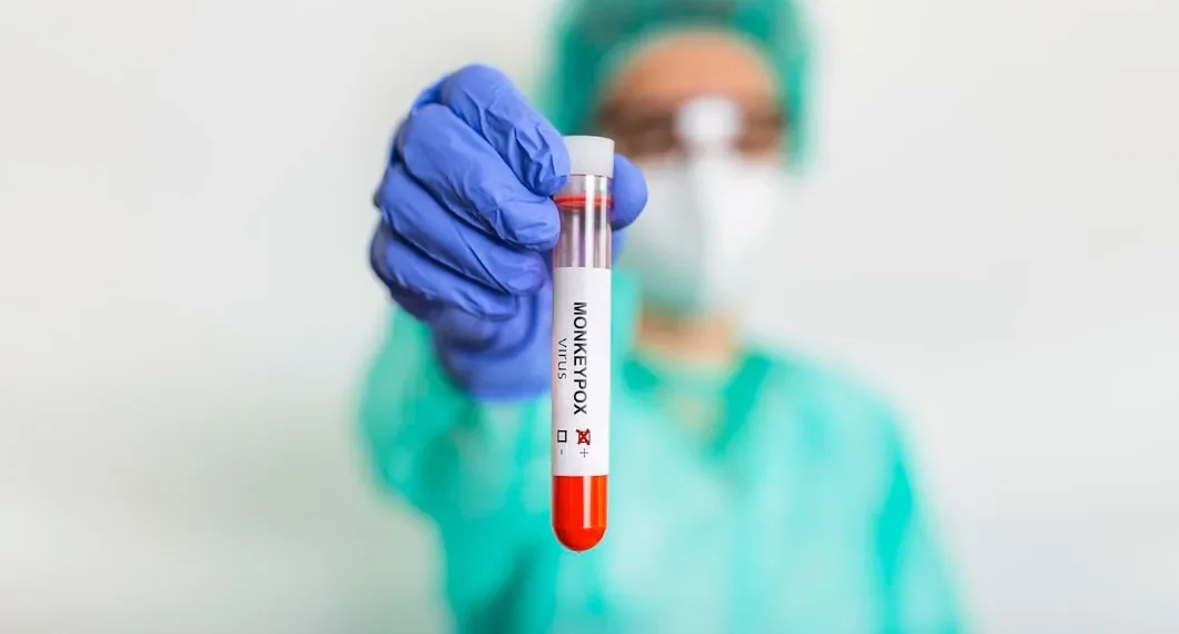 Brasil tem média de 40 a 50 novos casos de mpox por mês