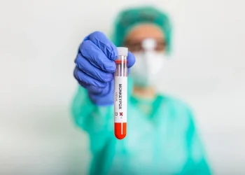 Brasil tem média de 40 a 50 novos casos de mpox por mês